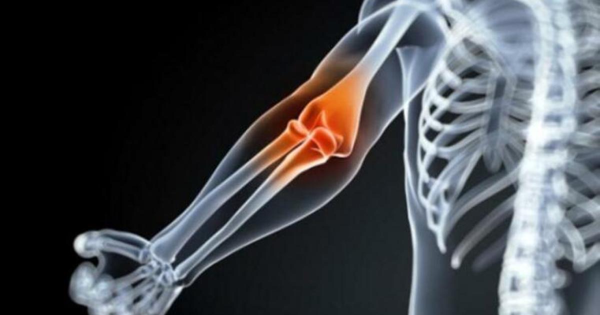pyelonephritis ízületi fájdalom térd artritisz kezelési tünetek