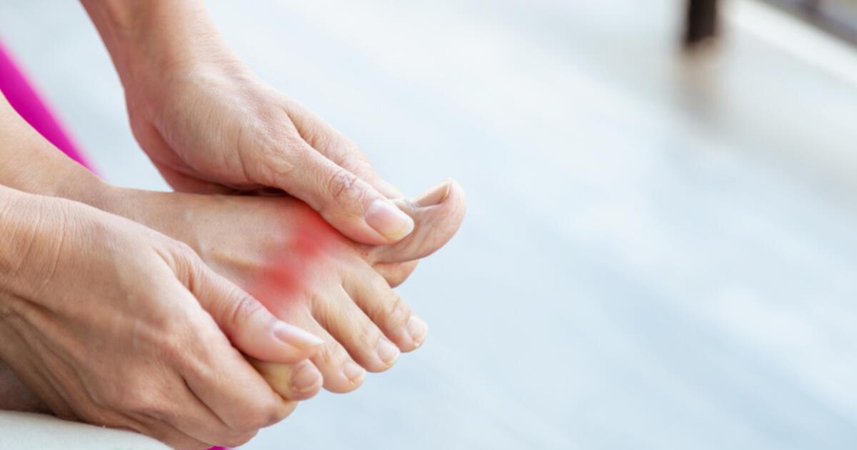 A paleolit diéta és a köszvény | Fogyás, zsírégetés | dr. Tihanyi