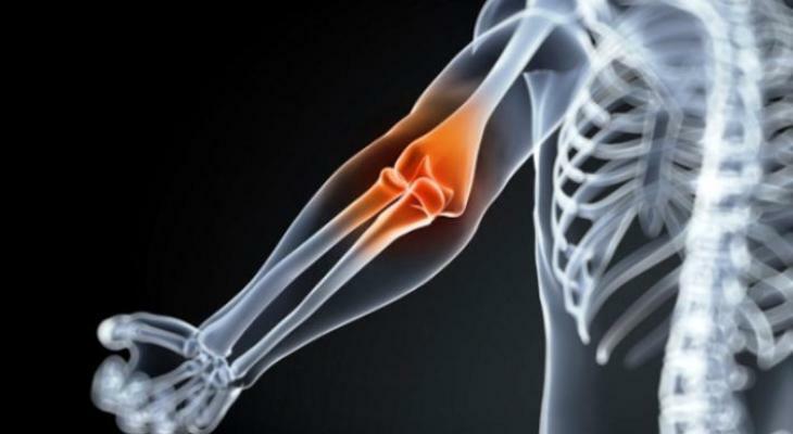 ízületi javítás rheumatoid arthritis esetén a vállízület kezelésének szubchondrális szklerózisa