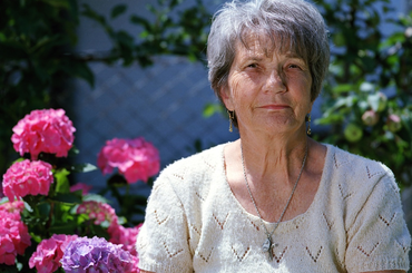 Természetes megoldások a barna öregedési foltokra