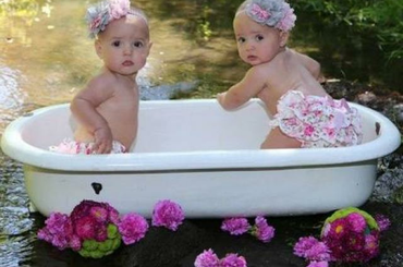 Egypetéjű ikrek Egypetéjű ikrek keletkezése, típusai, fejlődés az anyaméhben.