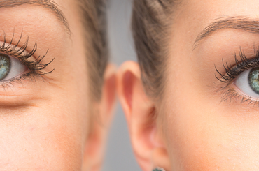 Bemutatjuk, hogy hogyan tudod a szódabikarbónát alkalmazni a szem alatti táskákra! 