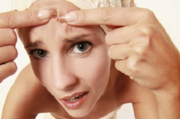 Pattanások kezelése házilag