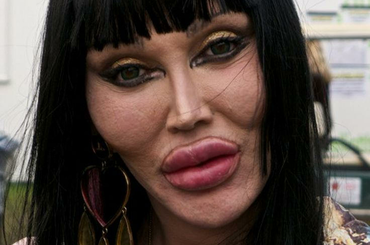 Ez nem jött össze - plasztikai beavatkozások előtte-utána