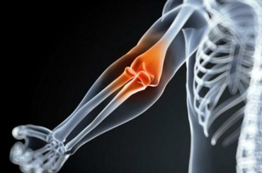 Ízületi problémák