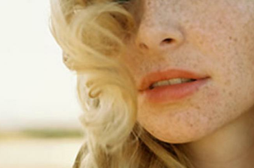 A pigmentfoltok eltüntetése, halványítása házilag