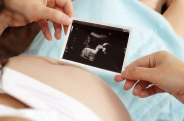 18 hetes terhes voltam, sajgó háttal és majd’ szétrobbanó hólyaggal, miközben a rutin ultrahangomra vártam. Ideges voltam. De nem a miatt, hogy minden rendben van-e, egészséges a baba vagy, hogy meg van mind a 10 ujja.