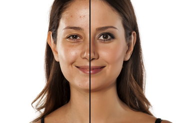 Megéri néha sminkmentes napot tartani