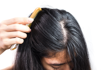 Gyorsan zsírosodó haj kezelése otthon, házilag egy egyszerű hajápolási rutin bevezetésével