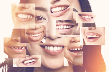 Legyen Neked is meseszép mosolyod Egészséges mosoly