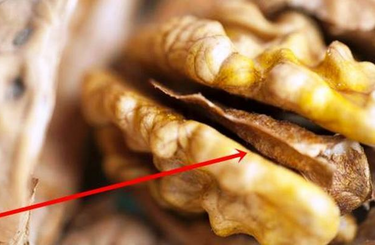 Ha megtörsz egy diót ne dobd el ezt a részét, mert aranyat ér!