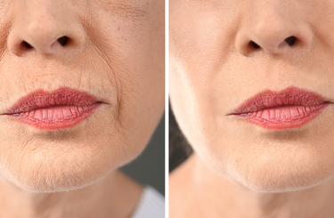 Ezektől a szokásoktól öregszel gyorsabban