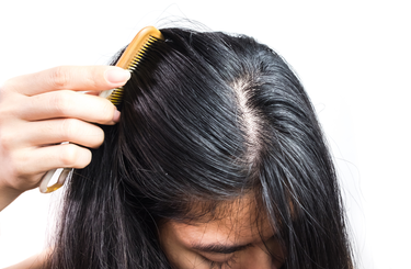 Gyorsan zsírosodó haj kezelése otthon, házilag egy egyszerű hajápolási rutin bevezetésével