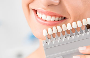 Lehet esztétikus a fogtömés?