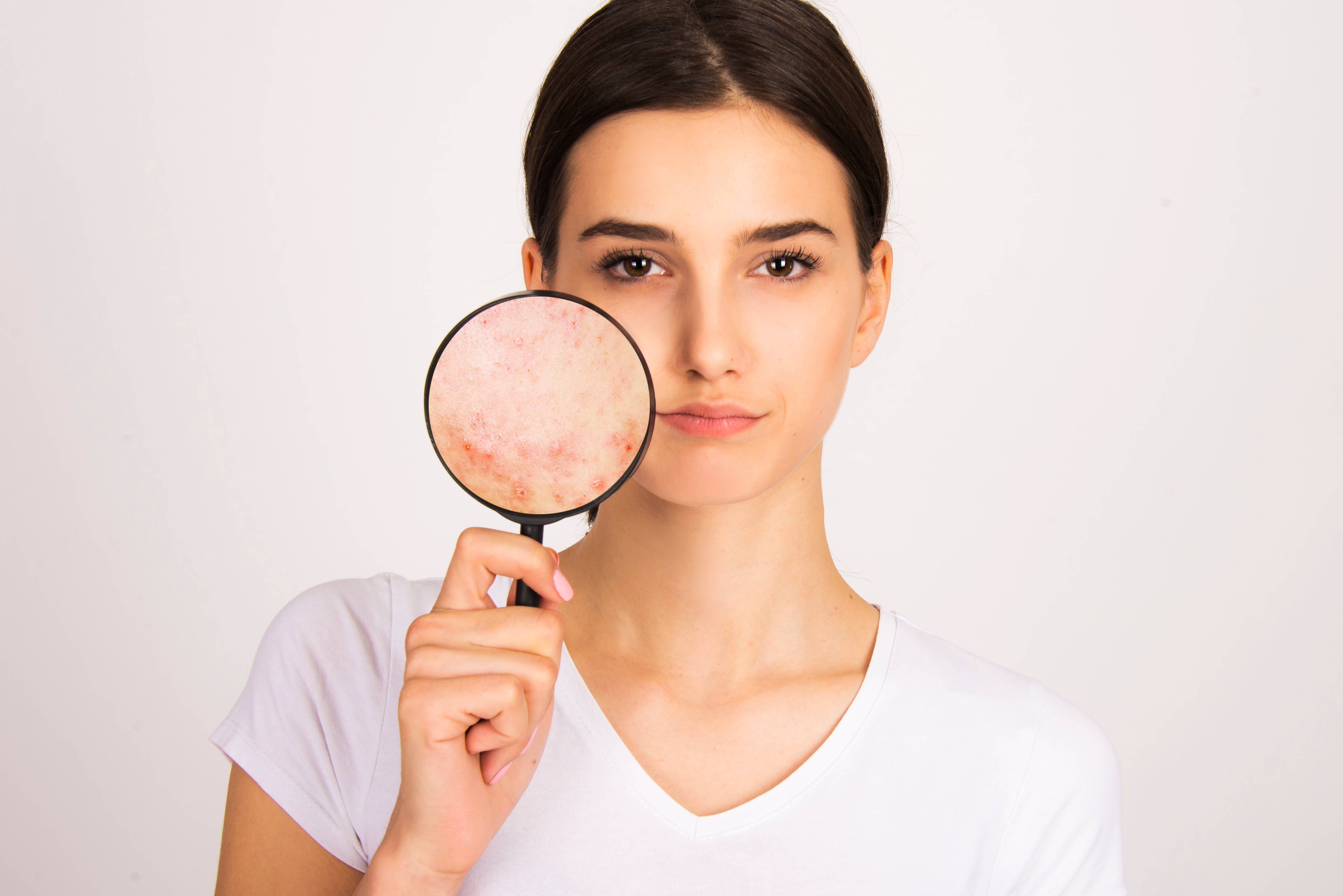 zsíros étel hatása zsíros étel hatása a bőrre